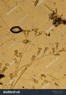  Vorticella! Un tourbillon microscopique de prédateur omniprésent dans l’eau douce.